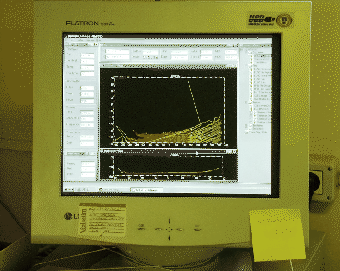 \begin{figure}\centering \epsfig{file=PS/MBEAM2.PS,width=7.5cm} \end{figure}