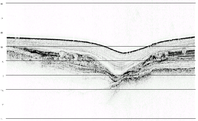 \begin{figure}\centering {\epsfig{file=PS/bosforello.ps,width=15cm}}
\end{figure}