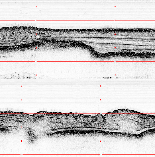 \begin{figure}
% latex2html id marker 1103
\epsfig{file=IMG/VERIGE_02.ps,width=1...
...aption[Verige Strais, CHIRP images.] {Verige Strais, CHIRP images.}
\end{figure}