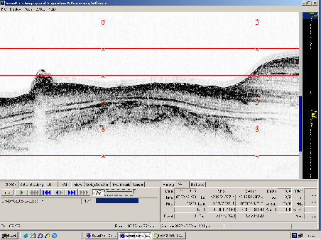 \begin{figure}\centerline{\epsfig{file=IMG/CAL03.eps,width=10cm}}
\end{figure}